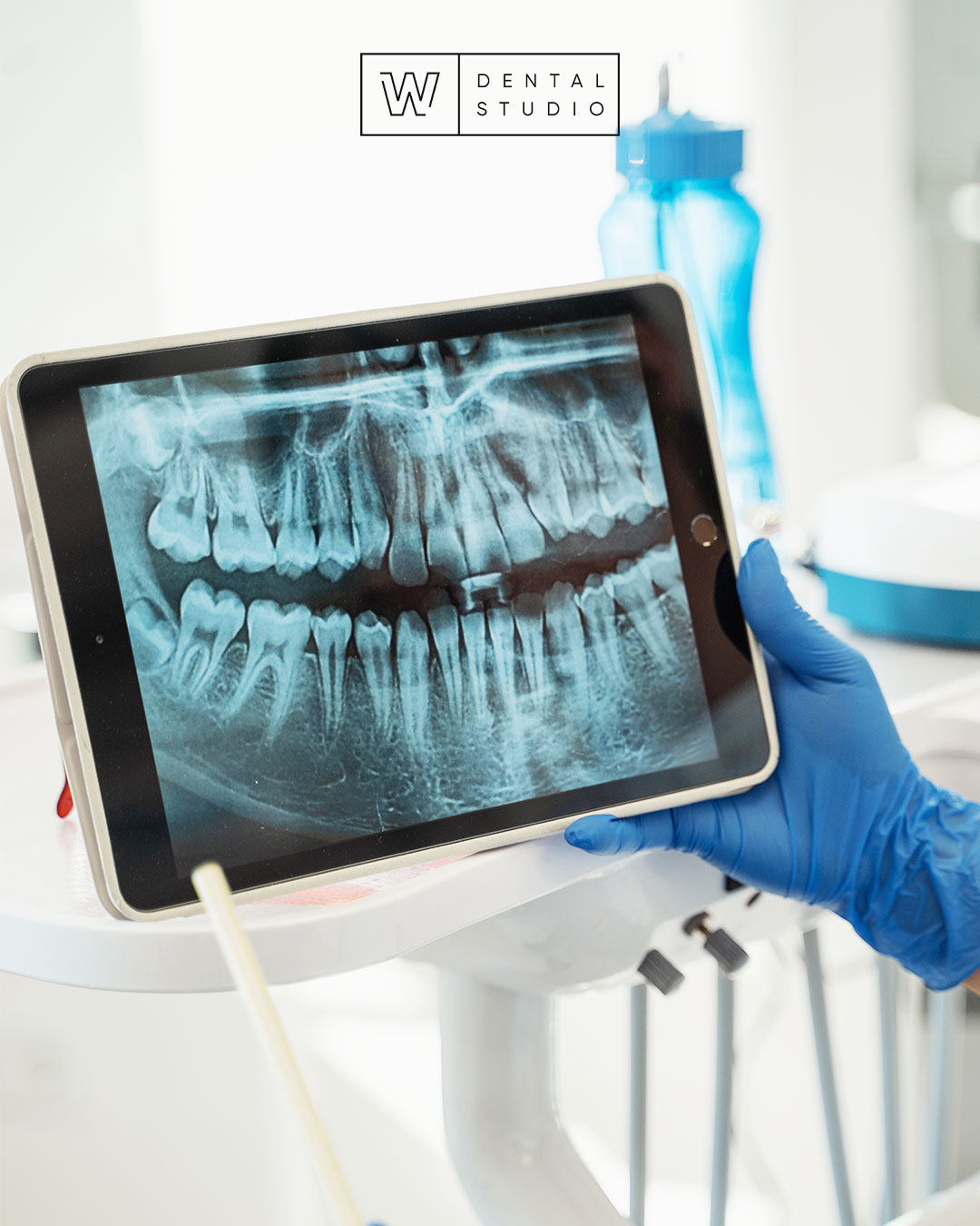 Did you know dental X-rays (radiographs) are images of your teeth that your dentist uses to evaluate your oral health? This can help your dentist to identify problems, like cavities, tooth decay, and impacted teeth.

📞 613-564-3300
📍 270 Richmond Rd, Ottawa, ON
🖥 https://www.wdentalstudio.com
📧 info@wdentalstudio.com