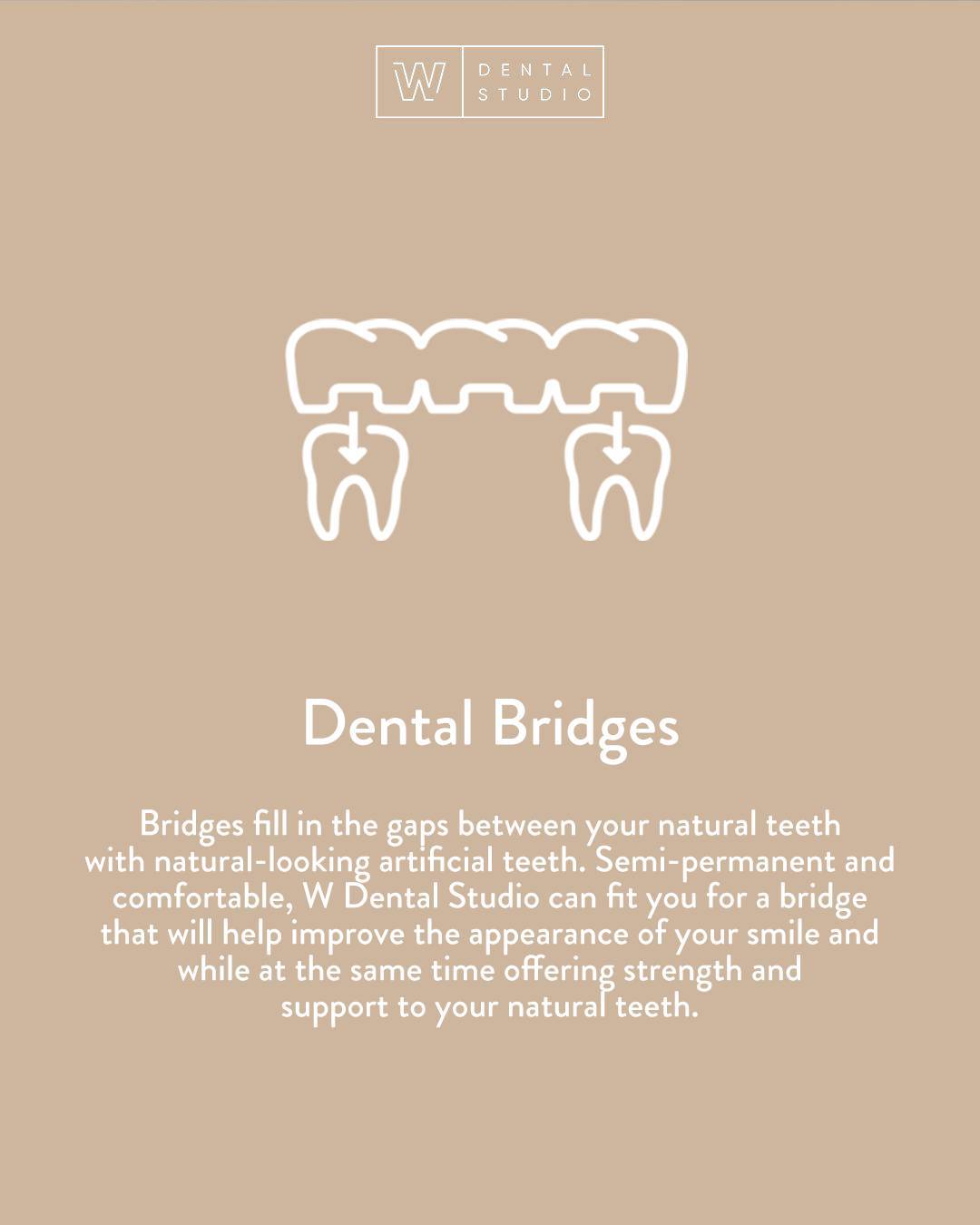Are you suffering from missing teeth, or becoming frustrated because you’re having trouble chewing, speaking or even biting food? If so, a bridge may be right for you. Bridges fill in the gaps between your natural teeth with natural-looking artificial teeth. Semi-permanent and comfortable, W Dental Studio can fit you for a bridge that will help improve the appearance of your smile and while at the same time offering strength and support to your natural teeth.

Book an appointment: 

📞 613-564-3300
📍 270 Richmond Rd, Ottawa, ON
💻 https://www.wdentalstudio.com
📧 info@wdentalstudio.com